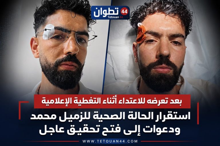 تطوان 44 يتضامن مع الزميلين محمد وحمزة ويطمئن على استقرار الحالة الصحية للزميل محمد